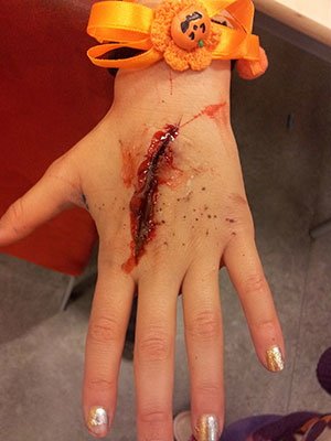 Reconstructive Plastic Surgery
